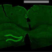 Photo of brain slice. 