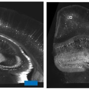 Boyden, E., Chen, F. & Tillberg, P. / MIT / Courtesy of National Institutes of Health A slice of a mouse brain (left) was expanded by nearly five-fold in each dimension by adding a water-soaking salt. The result — shown at smaller magnification (right) for comparison — has its anatomical structures are essentially unchanged.